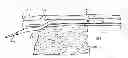 Fig. 01 - Lumen reentry mechanism and method