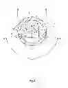Fig. 03 - Lumen reentry mechanism and method