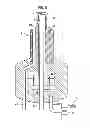 Fig. 06 - SURGICAL INSTRUMENT