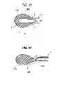 Fig. 13 - SURGICAL INSTRUMENT
