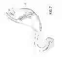 Fig. 12 - Intragastric device for treating obesity