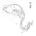 Fig. 17 - Intragastric device for treating obesity