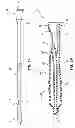 Fig. 02 - RAPID EXCHANGE TEMPORARY BLOOD FLOW CESSATION DEVICE FOR LARGE BORE CLOSURE