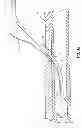 Fig. 07 - RAPID EXCHANGE TEMPORARY BLOOD FLOW CESSATION DEVICE FOR LARGE BORE CLOSURE
