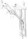 Fig. 08 - RAPID EXCHANGE TEMPORARY BLOOD FLOW CESSATION DEVICE FOR LARGE BORE CLOSURE