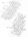 Fig. 04 - Nasal dilator and methods of fabricating medical devices