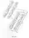 Fig. 21 - Nasal dilator and methods of fabricating medical devices