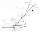 Fig. 01 - Vascular closure device with improved side loading
