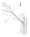 Fig. 12 - Vascular closure device with improved side loading