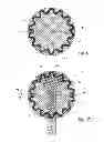 Fig. 05 - Umbilical hernia prosthesis