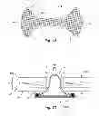 Fig. 10 - Umbilical hernia prosthesis