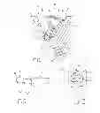 Fig. 02 - Orthopedic fastener blocking system