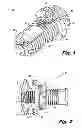 Fig. 02 - Interspinous process implant having deployable anchor blades