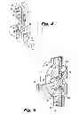 Fig. 04 - Interspinous process implant having deployable anchor blades