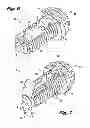 Fig. 05 - Interspinous process implant having deployable anchor blades