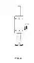 Fig. 07 - Rod system for gradual dynamic spinal fixation