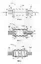 Fig. 03 - EXPANDABLE SPINAL RODS AND METHODS OF USE