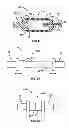 Fig. 04 - EXPANDABLE SPINAL RODS AND METHODS OF USE
