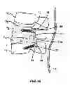 Fig. 10 - EXPANDABLE SPINAL RODS AND METHODS OF USE