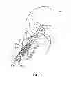 Fig. 04 - Sheaths for implantable fixation devices