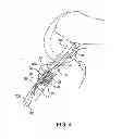 Fig. 05 - Sheaths for implantable fixation devices