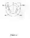 Fig. 07 - Apparatus and methods for reduction of vertebral bodies in a spine