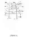 Fig. 13 - Apparatus and methods for reduction of vertebral bodies in a spine