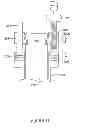 Fig. 14 - Apparatus and methods for reduction of vertebral bodies in a spine