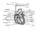 Fig. 02 - Method and apparatus for intrachamber resynchronization