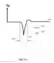 Fig. 12 - Rate initialization and overdrive pacing for capture threshold testing