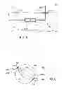 Fig. 04 - Multiplex Electrodes for Applying Transcutaneous Interferential Current