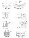 Fig. 08 - Multiplex Electrodes for Applying Transcutaneous Interferential Current