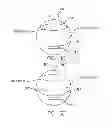 Fig. 11 - Visual prosthesis with user interface