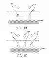 Fig. 14 - Visual prosthesis with user interface