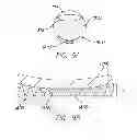 Fig. 17 - Visual prosthesis with user interface