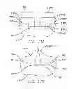 Fig. 19 - Visual prosthesis with user interface