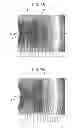 Fig. 07 - PHOTORADIATION DEVICE AND PHOTORADIATION THERAPY/PROPHYLAXIS DEVICE COMPRISING SAME