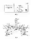 Fig. 03 - Ophthalmic treatment device, system, and method of use