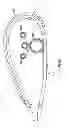 Fig. 16 - Ophthalmic treatment device, system, and method of use
