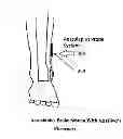 Fig. 01 - Aesculapius Probe System