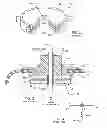 Fig. 03 - Low impedance oxide resistant grounded capacitor for an AIMD