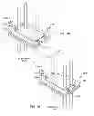 Fig. 34 - Low impedance oxide resistant grounded capacitor for an AIMD