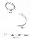 Fig. 05 - Method of treating atherosclerotic occlusive disease