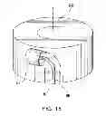 Fig. 09 - Method of treating atherosclerotic occlusive disease