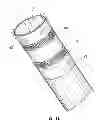 Fig. 10 - Method of treating atherosclerotic occlusive disease