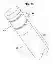 Fig. 14 - Method of treating atherosclerotic occlusive disease