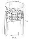 Fig. 15 - Method of treating atherosclerotic occlusive disease