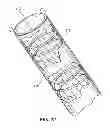 Fig. 16 - Method of treating atherosclerotic occlusive disease