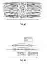 Fig. 19 - Method of treating atherosclerotic occlusive disease