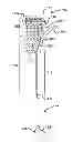 Fig. 01 - Controlled deployable medical device and method of making the same